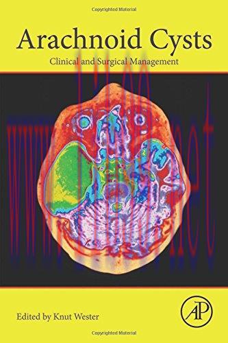 [AME]Arachnoid Cysts: Clinical and Surgical Management (EPUB)