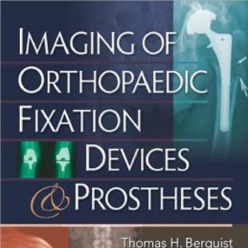 Imaging of Orthopaedic Fixation Devices and Prostheses