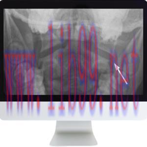 [AME]Neuroradiology Review for the Practicing Radiologist 2018 (ARRS VIDEOS) (CME VIDEOS)