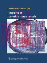 [PDF]Imaging of Carotid Artery Stenosis