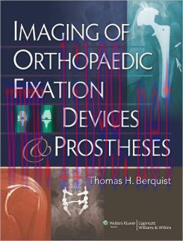 [AME]Imaging of Orthopaedic Fixation Devices and Prostheses (EPUB)