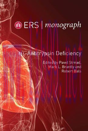 [AME]ERS Monograph 85: Alpha-1-Antitrypsin Defieciency (PDF)