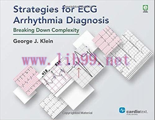 [PDF]Strategies for ECG Arrhythmia Diagnosis