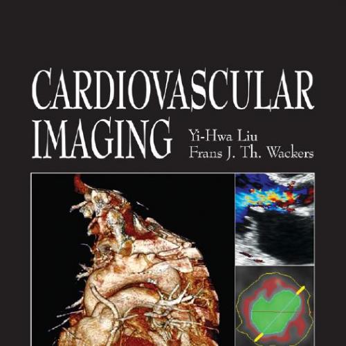 Cardiovascular Imaging by Yi-Hwa Liu, Frans J. Th. Wackers
