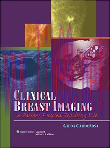[PDF]Clinical Breast Imaging - A Patient Focused Teaching File