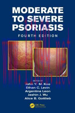[AME]Moderate to Severe Psoriasis, Fourth Edition