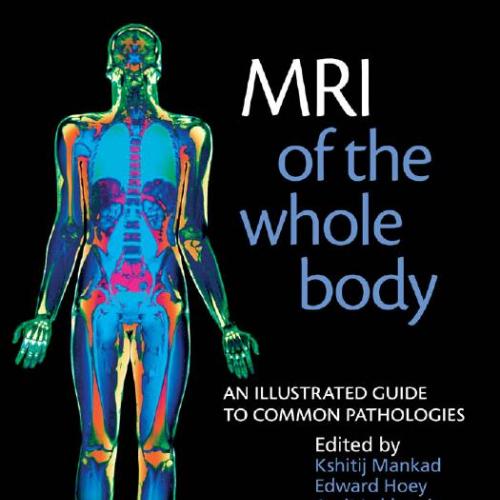 MRI of the Whole Body An Illustrated Guide for Common Pathologies
