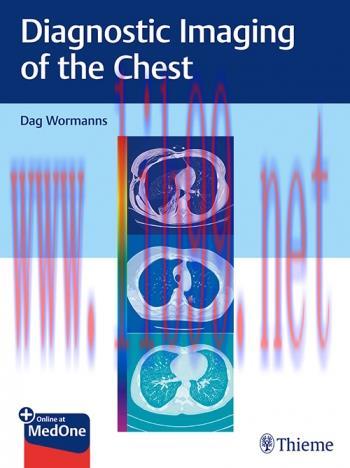 [PDF]Diagnostic Imaging of the Chest