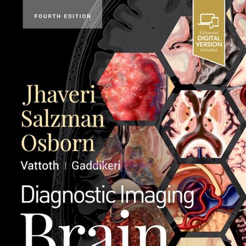 [AME]Diagnostic Imaging: Brain, 4th Edition (ePub+Videos)
