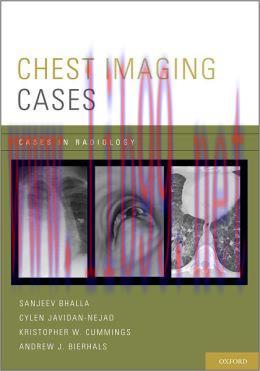[AME]Chest Imaging Cases (Cases in Radiology)