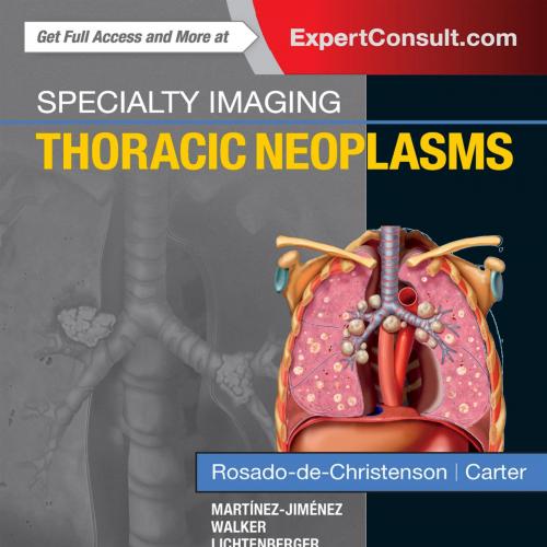 Specialty Imaging_ Thoracic Neoplasms