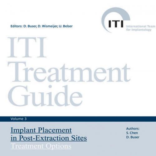 ITI Treatment Guide 3