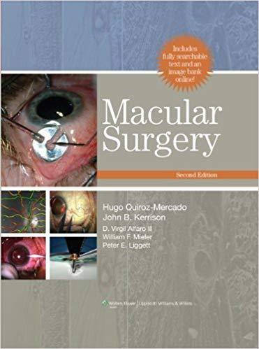 Macular Surgery, 2nd Edition