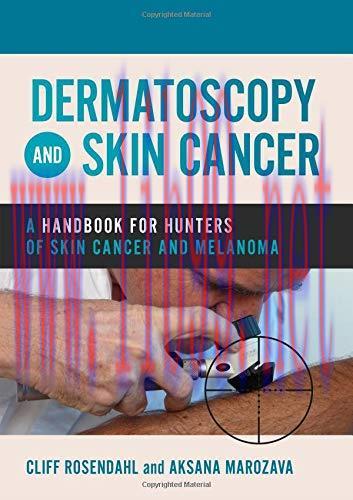 [AME]Dermatoscopy and Skin Cancer: A handbook for hunters of skin cancer and melanoma (Original...