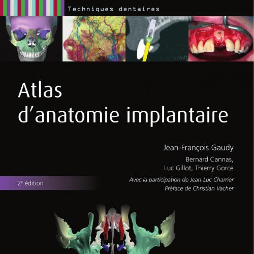 Atlas d'anatomie implantaire