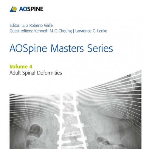 AOSpine Masters Series, Volume 4_ Adult Spinal Deformities - Www.Yutou.Org