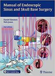 [PDF]Manual of Endoscopic Sinus and Skull Base Surgery