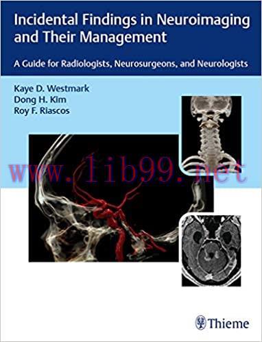 [PDF]Incidental Findings in Neuroimaging and Their Management