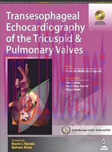 [AME]Transesophageal Echocardiography of the Tricuspid and Pulmonary Valves