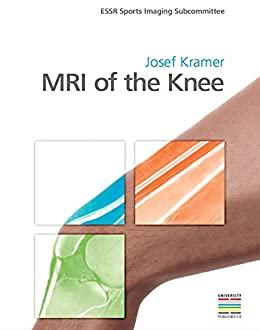 (PDF)MRI of the Knee