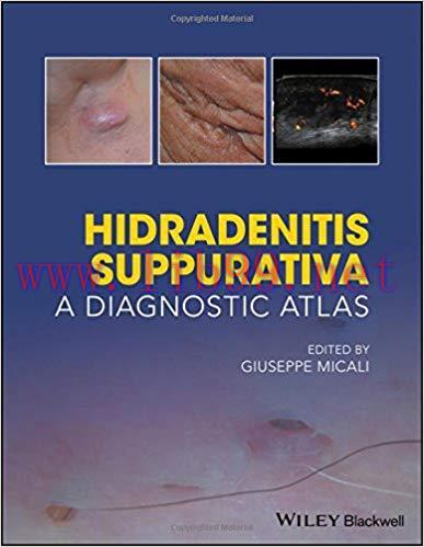 [PDF]Hidradenitis Suppurativa: A Diagnostic Atlas