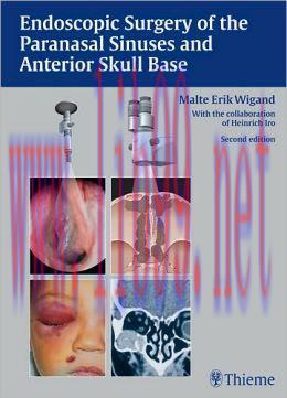 [AME]Endoscopic Surgery of the Paranasal Sinuses and Anterior Skull Base, 2nd Edition