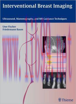 [AME]Interventional Breast Imaging: Ultrasound, Mammography, and MR Guidance Techniques