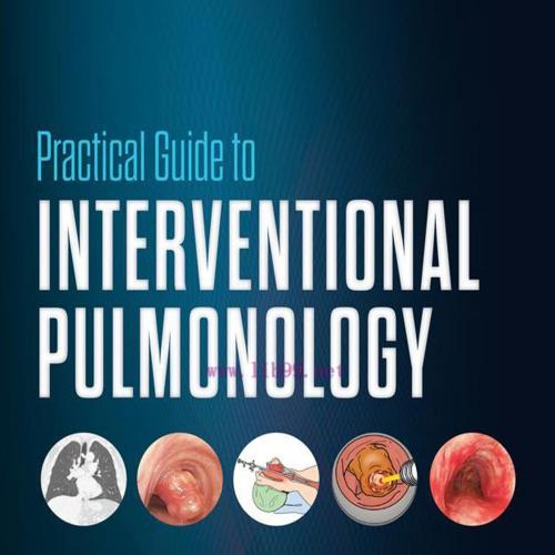 [AME]Practical Guide to Interventional Pulmonology (EPUB)