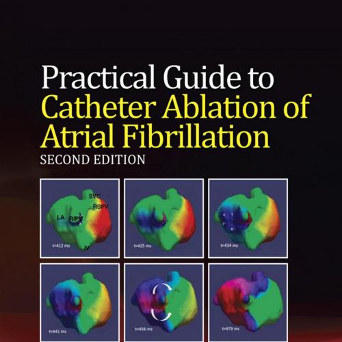 Practical Guide to Catheter Ablation of Atrial Fibrillation 2nd Edition