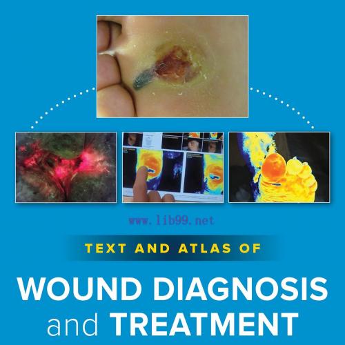 [AME]Text and Atlas of Wound Diagnosis and Treatment, 3rd Edition (Original PDF)