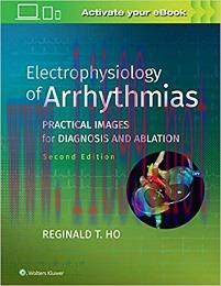 [AME]Electrophysiology of Arrhythmias: Practical Images for Diagnosis and Ablation, 2nd Edition...