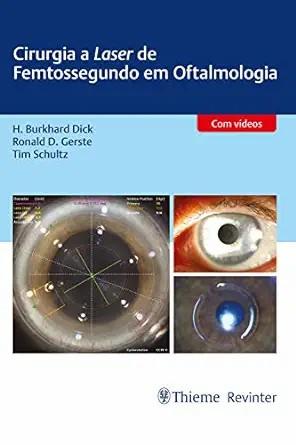 [AME]Cirurgia a Laser de Femtossegundo em Oftalmologia (Portuguese Edition) (Original PDF)