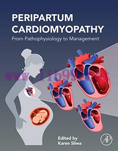 [AME]Peripartum Cardiomyopathy: From_ Pathophysiology to Management (Original PDF)
