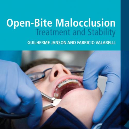 Open-Bite Malocclusion Treatment and Stability