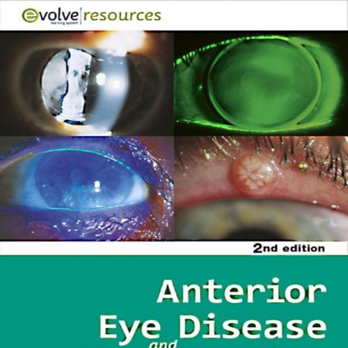 Anterior Eye Disease and Therapeutics A-Z 2nd - Adrian S. Bruce & Michael Stephen Loughnan