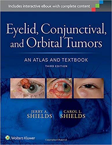 Eyelid, Conjunctival, and Orbital Tumors - An Atlas and Textbook, 3rd Edition+EPUB版
