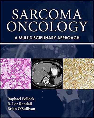 Sarcoma Oncology A Multidisciplinary Approach