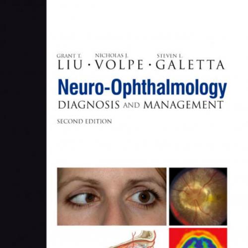 Neuro-Ophthalmology_ Diagnosis and Management 2nd - Grant T. Liu MD, Nicholas J. Volpe MD, Stev...