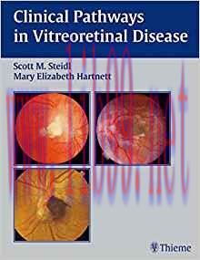 [PDF]Clinical Pathways In Vitreoretinal Disease, 1e [Thieme] [2003]