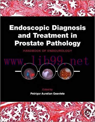 [PDF]Endoscopic Diagnosis and Treatment in Prostate Pathology