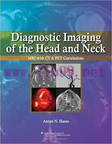[PDF]Diagnostic Imaging of the Head and Neck - MRI with CT and PET Correlations