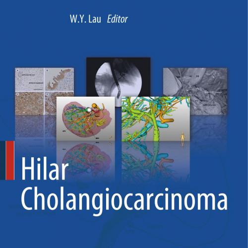 Hilar Cholangiocarcinoma