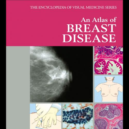 Atlas of Breast Disease