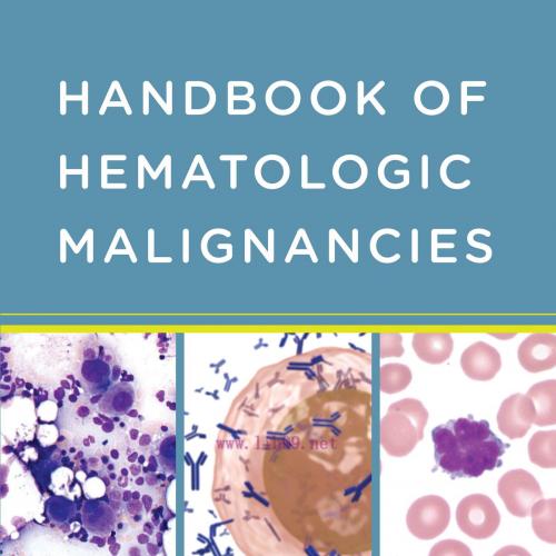 [AME]Handbook of Hematologic Malignancies (PDF)