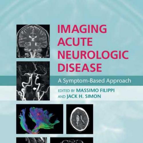 Imaging Acute Neurologic Disease A Symptom-Based Approach