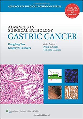 Advances in Surgical Pathology - Gastric Cancer+CHM版