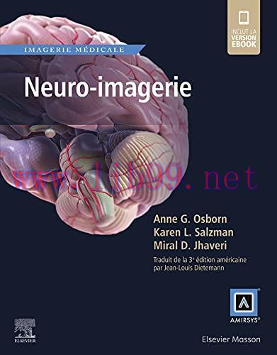 [AME]Neuro-imagerie (R&eacute;f. en Imagerie M&eacute;dicale) (French Edition) (EPUB)