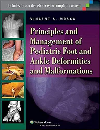 Principles and Management of Pediatric Foot and Ankle Deformitie