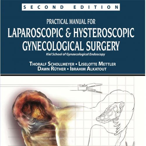 Practical Manual for Laparoscopic and Hysteroscopic Gynecological Surgery-Wei Zhi