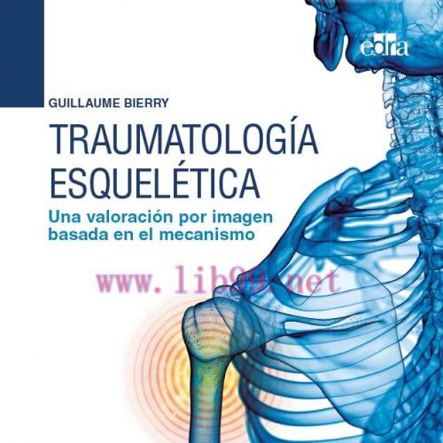 [AME]Traumatolog&iacute;a esquel&eacute;tica Una valoraci&oacute;n por imagen basada en el mecanismo (EPUB)